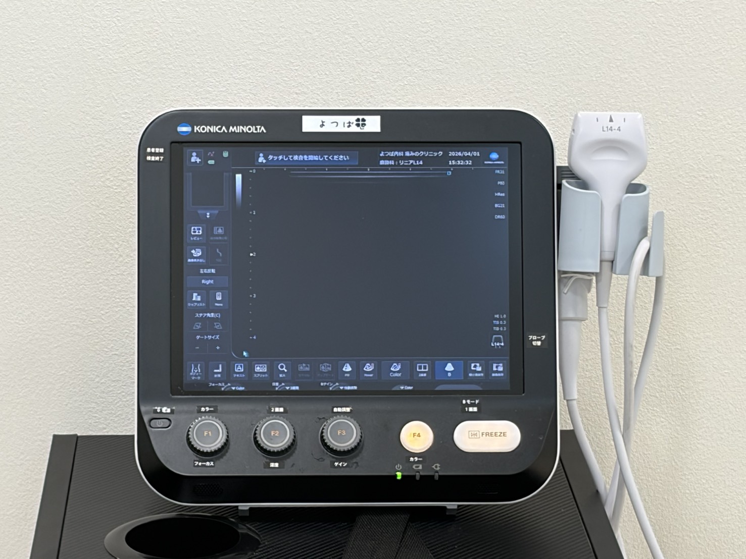 超音波診断装置（エコー）